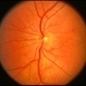 Normal Fundus Photo